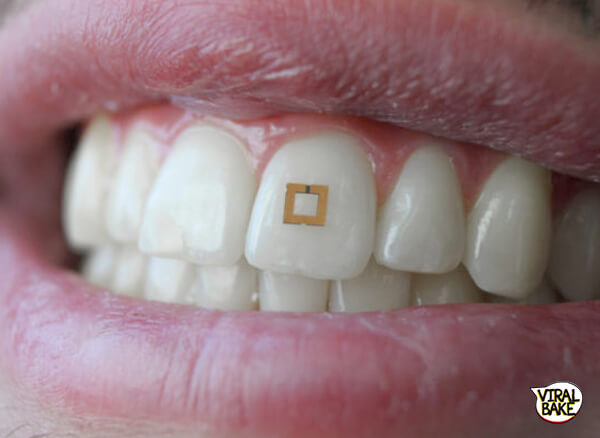 tooth sensor Latest Healthcare Breakthroughs