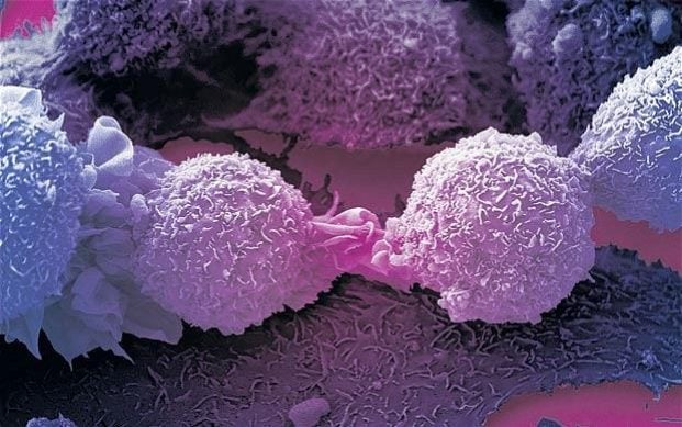 Cell that Can Kill Most Cancers