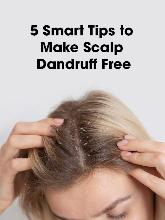 5 Smart Tips to Make Scalp Dandruff Free